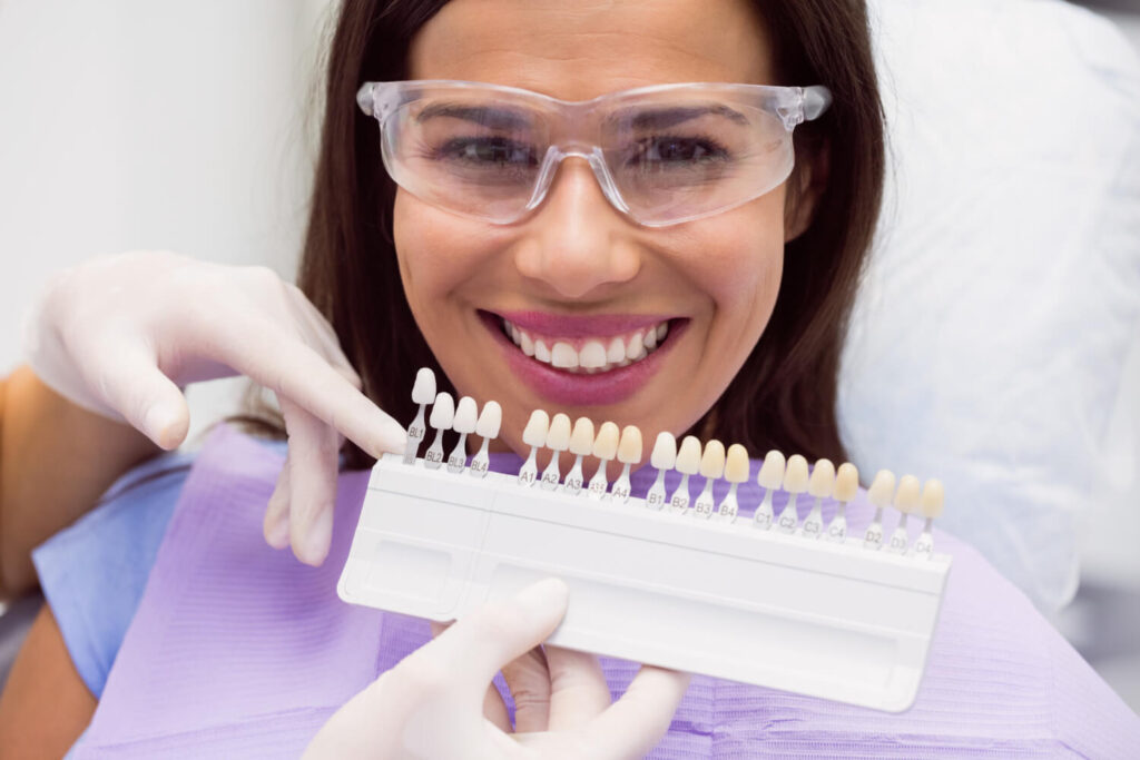 Dentista seleciona a cor para facetas de resina em sessão única no Catete, comparando escala de tons com o sorriso da paciente.